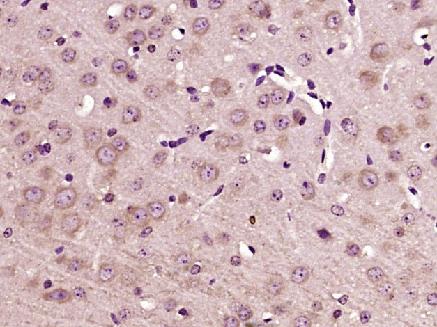 DEXI Antibody in Immunohistochemistry (Paraffin) (IHC (P))