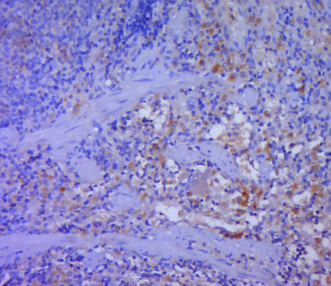 DFNA5 Antibody in Immunohistochemistry (Paraffin) (IHC (P))