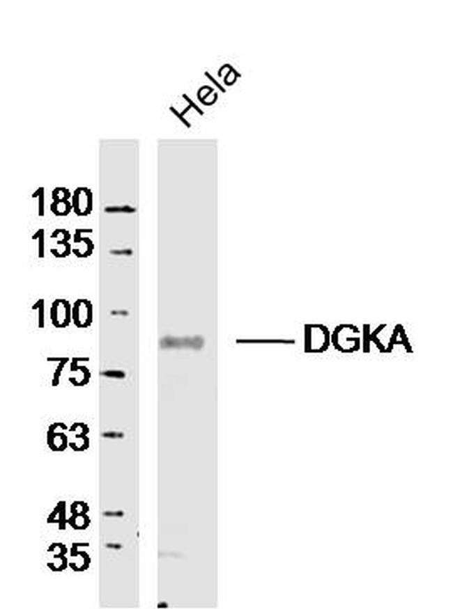 DGKA Antibody in Western Blot (WB)