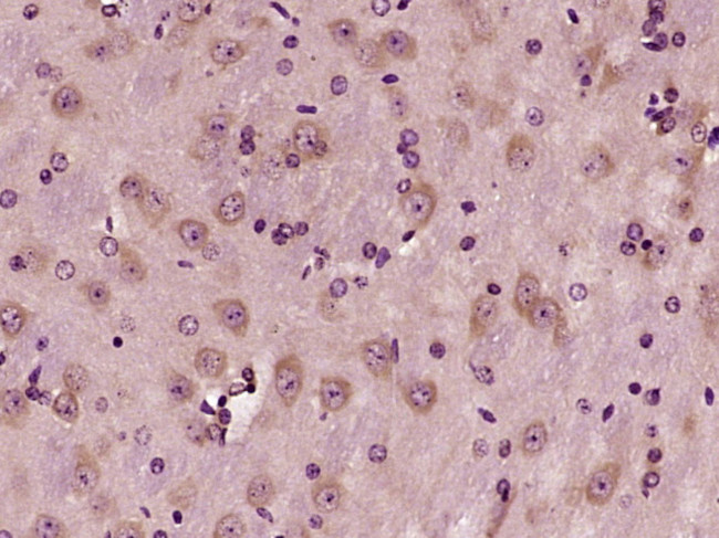 DGKB Antibody in Immunohistochemistry (Paraffin) (IHC (P))