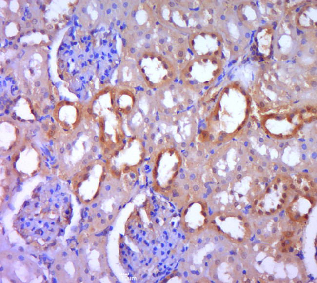 DGKH Antibody in Immunohistochemistry (Paraffin) (IHC (P))