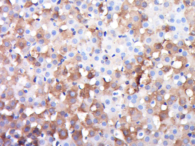 DGKK Antibody in Immunohistochemistry (Paraffin) (IHC (P))
