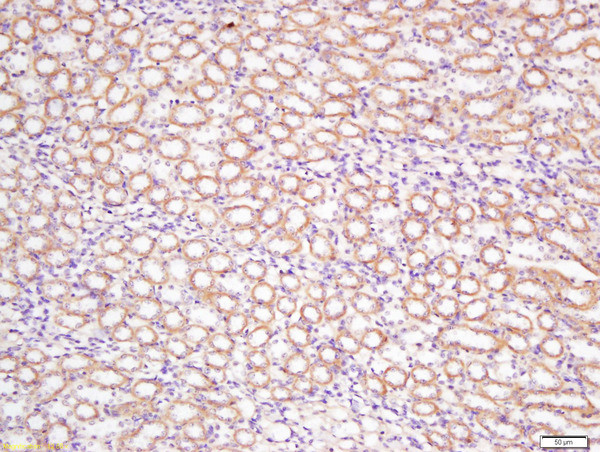 DCTN5 Antibody in Immunohistochemistry (Paraffin) (IHC (P))