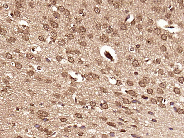 DHX30 Antibody in Immunohistochemistry (Paraffin) (IHC (P))