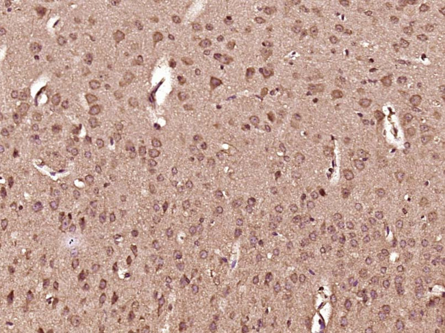 DHX36 Antibody in Immunohistochemistry (Paraffin) (IHC (P))