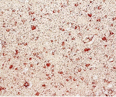 CD68 Antibody in Immunohistochemistry (Paraffin) (IHC (P))