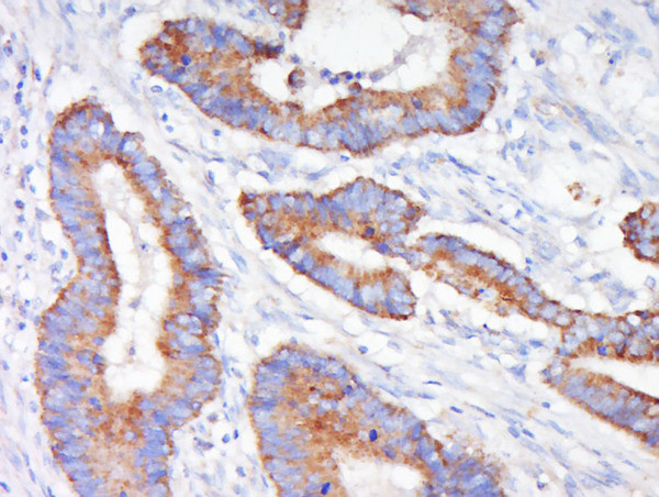 MEK1 Antibody in Immunohistochemistry (Paraffin) (IHC (P))