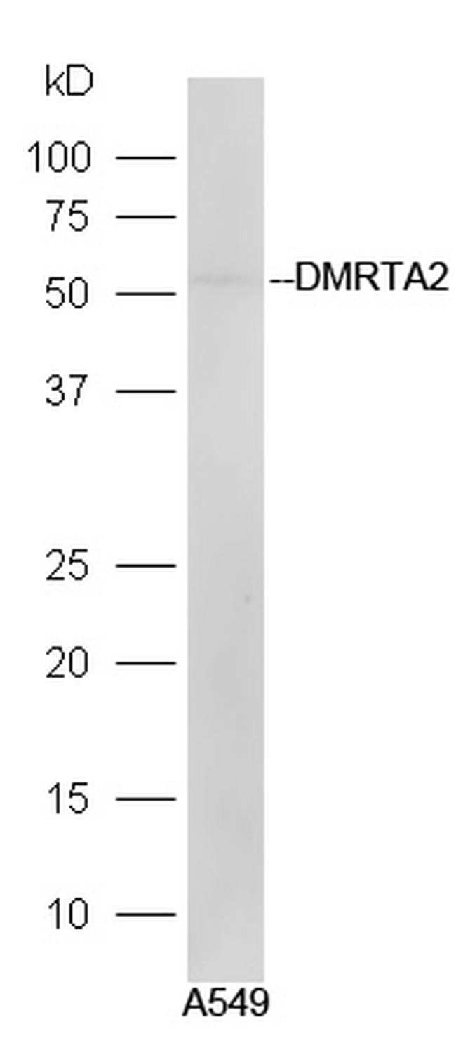 DMRTA2 Antibody in Western Blot (WB)