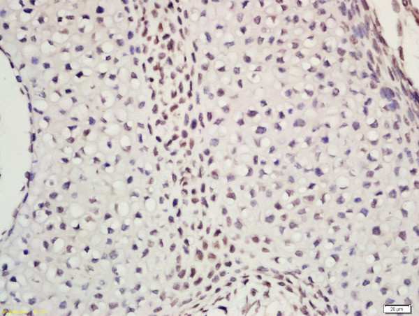 DNA polymerase epsilon subunit 2 Antibody in Immunohistochemistry (Paraffin) (IHC (P))