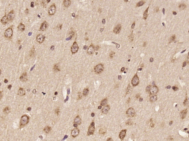 DNAH6 Antibody in Immunohistochemistry (Paraffin) (IHC (P))