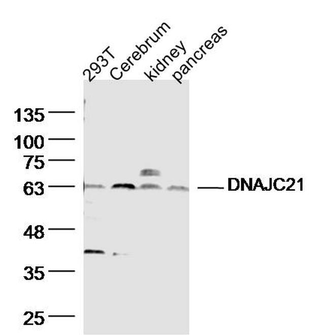 DNAJC21 Antibody in Western Blot (WB)