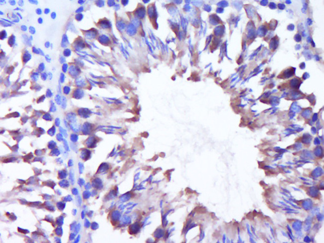DNAJC5G Antibody in Immunohistochemistry (Paraffin) (IHC (P))