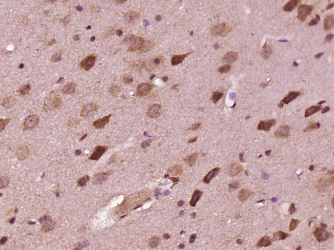 DND1 Antibody in Immunohistochemistry (Paraffin) (IHC (P))