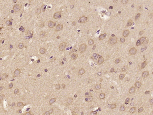 DOLPP1 Antibody in Immunohistochemistry (Paraffin) (IHC (P))