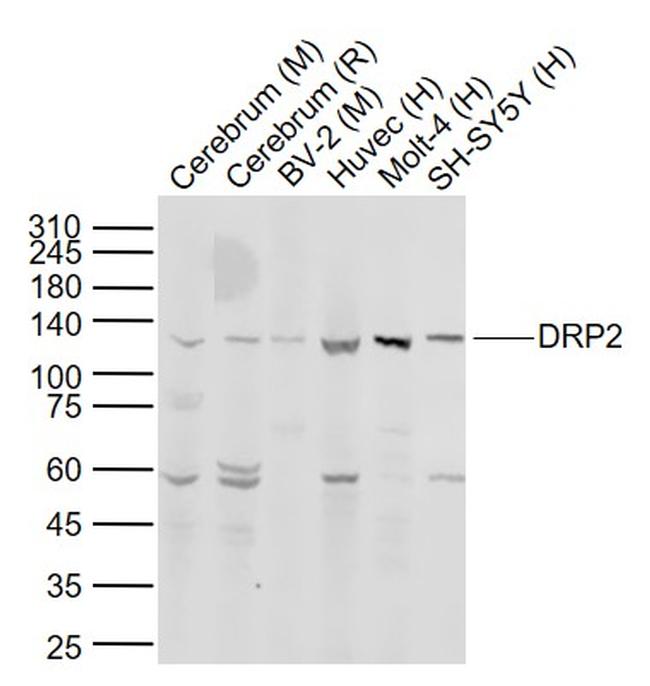 DRP2 Antibody in Western Blot (WB)