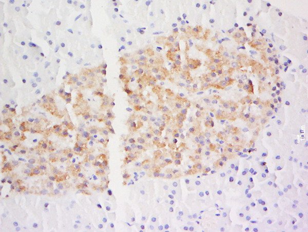 DSCR3 Antibody in Immunohistochemistry (Paraffin) (IHC (P))