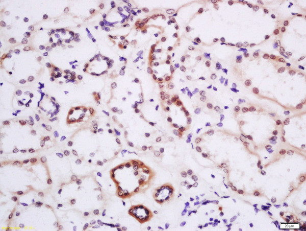 DTX3L Antibody in Immunohistochemistry (Paraffin) (IHC (P))