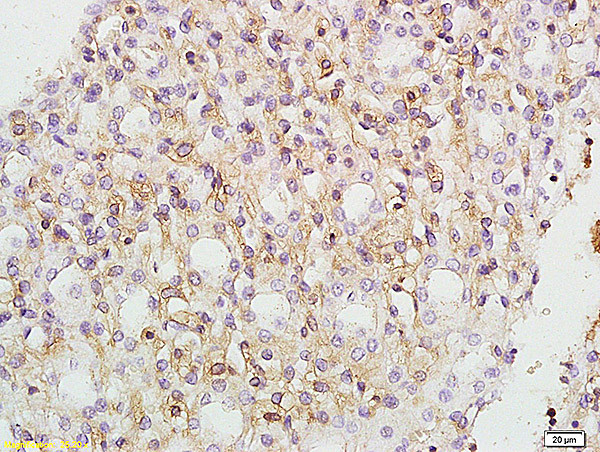 VCP Antibody in Immunohistochemistry (Paraffin) (IHC (P))