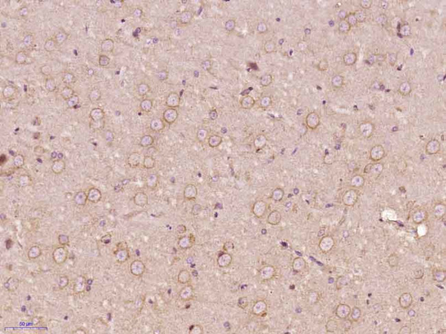 DUSP26 Antibody in Immunohistochemistry (Paraffin) (IHC (P))