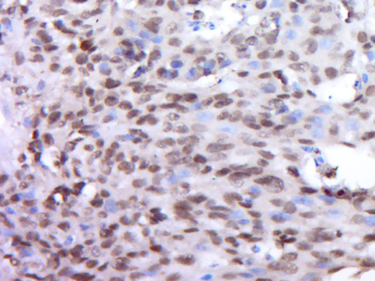 DUX4L9 Antibody in Immunohistochemistry (Paraffin) (IHC (P))