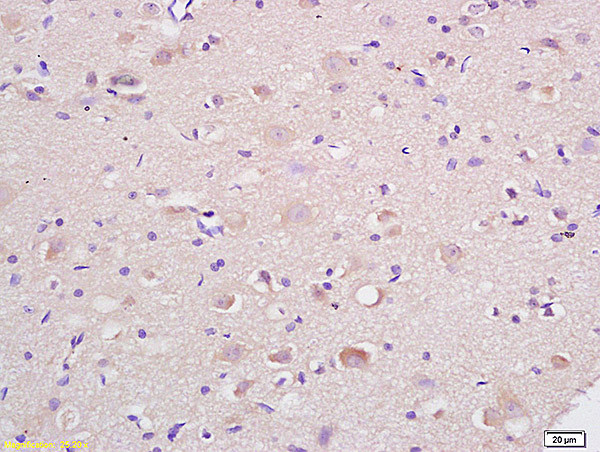 HSP75/TRAP1 Antibody in Immunohistochemistry (Paraffin) (IHC (P))