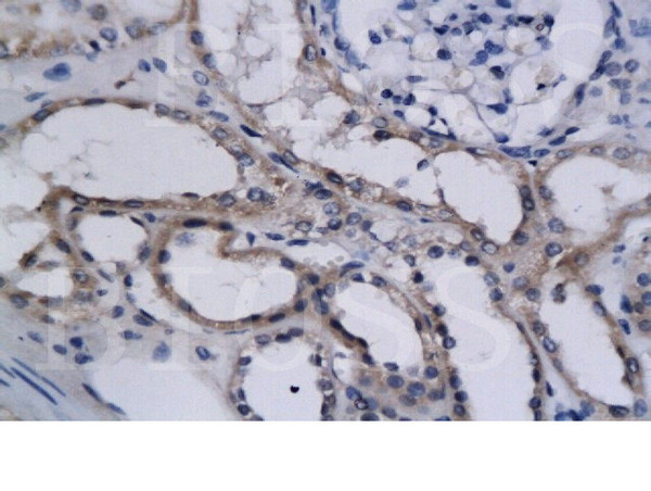 HIF2 alpha Antibody in Immunohistochemistry (Paraffin) (IHC (P))