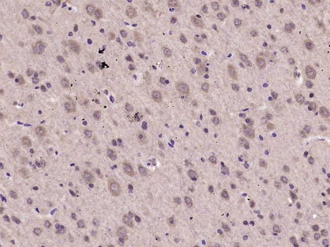 Phospho-EIF2S1 (Ser49) Antibody in Immunohistochemistry (Paraffin) (IHC (P))