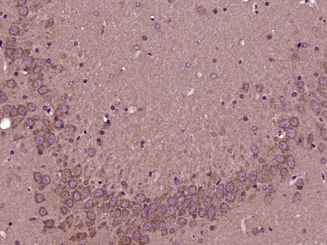 eIF4A2 Antibody in Immunohistochemistry (Paraffin) (IHC (P))