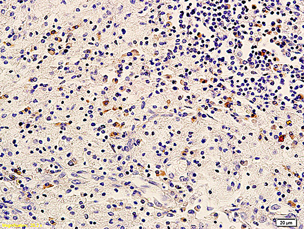 ErbB-3/HER3 Antibody in Immunohistochemistry (Paraffin) (IHC (P))