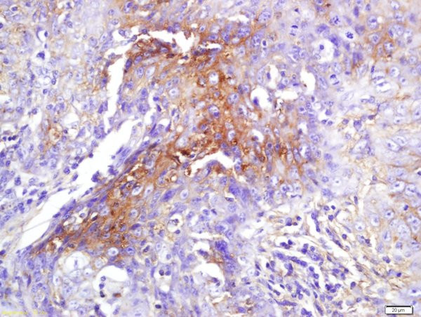 eIF4H Antibody in Immunohistochemistry (Paraffin) (IHC (P))