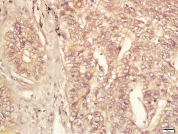 eIF4ENIF1 Antibody in Immunohistochemistry (Paraffin) (IHC (P))