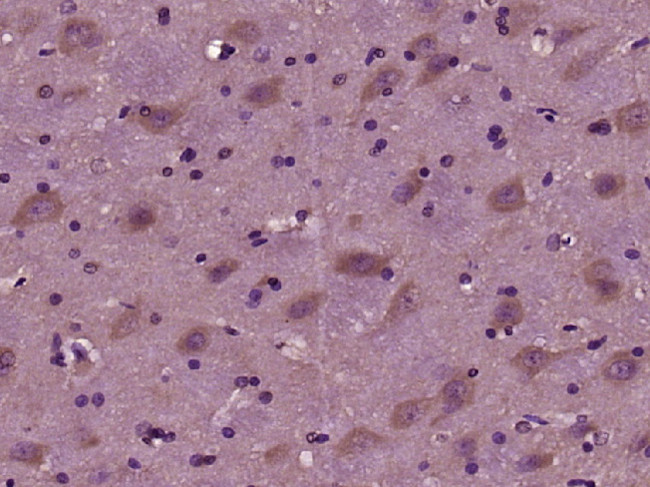 EMID1 Antibody in Immunohistochemistry (Paraffin) (IHC (P))