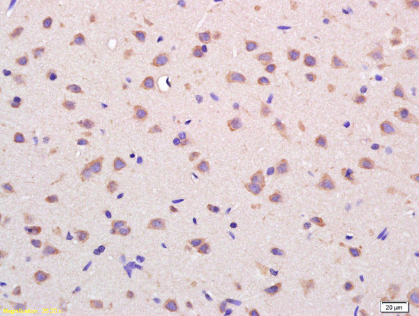 VDAC Antibody in Immunohistochemistry (Paraffin) (IHC (P))