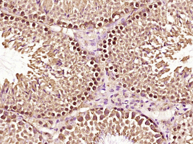ERRFI1 Antibody in Immunohistochemistry (Paraffin) (IHC (P))