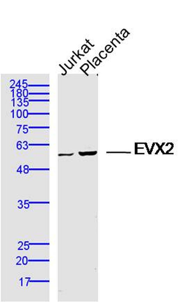 EVX2 Antibody in Western Blot (WB)