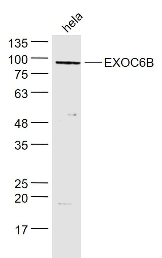 EXOC6B Antibody in Western Blot (WB)