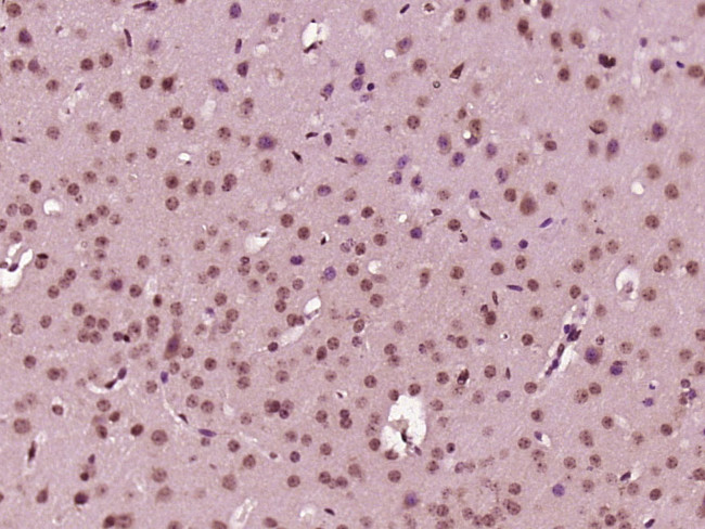 EXOSC4 Antibody in Immunohistochemistry (Paraffin) (IHC (P))