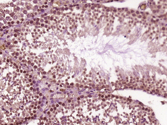 EXOSC5 Antibody in Immunohistochemistry (Paraffin) (IHC (P))