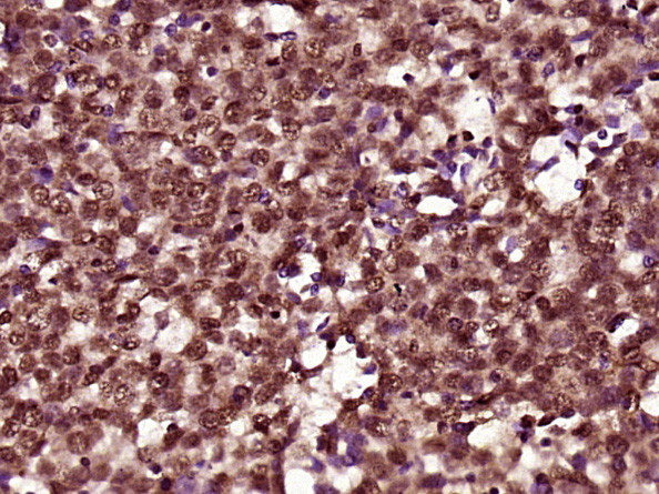 FAM118B Antibody in Immunohistochemistry (Paraffin) (IHC (P))