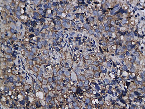 Annexin VI Antibody in Immunohistochemistry (Paraffin) (IHC (P))