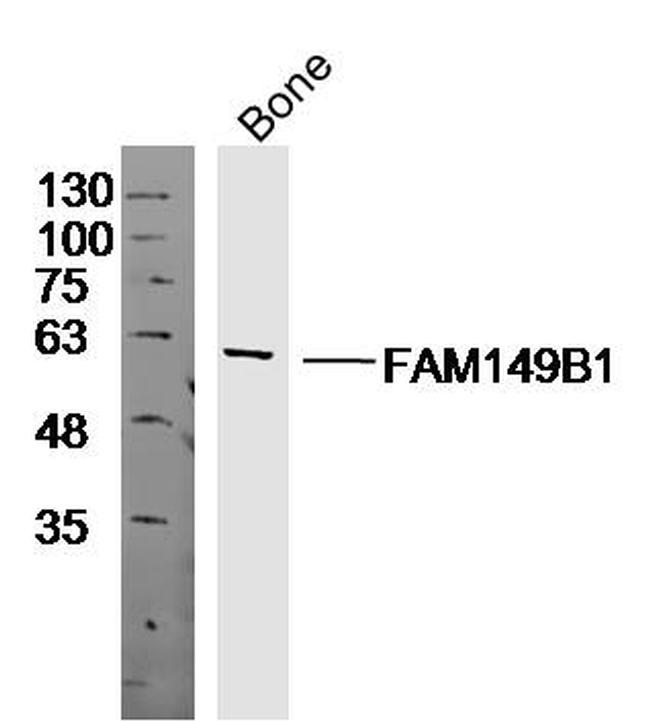 FAM149B1 Antibody in Western Blot (WB)