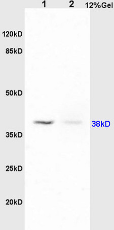 PAFR Antibody in Immunohistochemistry (Paraffin) (IHC (P))