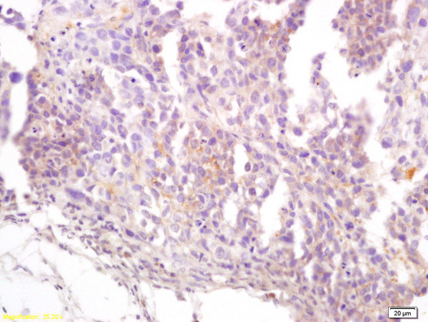 CD22/BLCAM Antibody in Immunohistochemistry (Paraffin) (IHC (P))