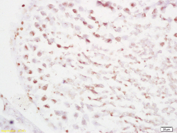 RBBP6/P2P-R Antibody in Immunohistochemistry (Paraffin) (IHC (P))