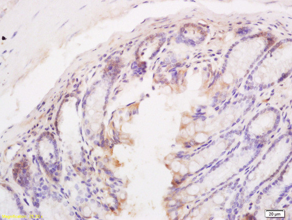 Bim/BCL2L11 Antibody in Immunohistochemistry (Paraffin) (IHC (P))