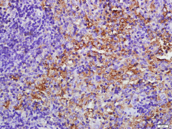 E2AK2/PKR Antibody in Immunohistochemistry (Paraffin) (IHC (P))