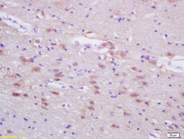 FASN/Fatty Acid Synthase Antibody in Immunohistochemistry (Paraffin) (IHC (P))