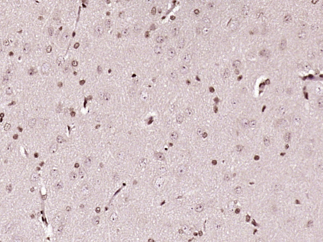 C1orf103 Antibody in Immunohistochemistry (Paraffin) (IHC (P))