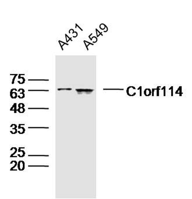C1orf114 Antibody in Western Blot (WB)