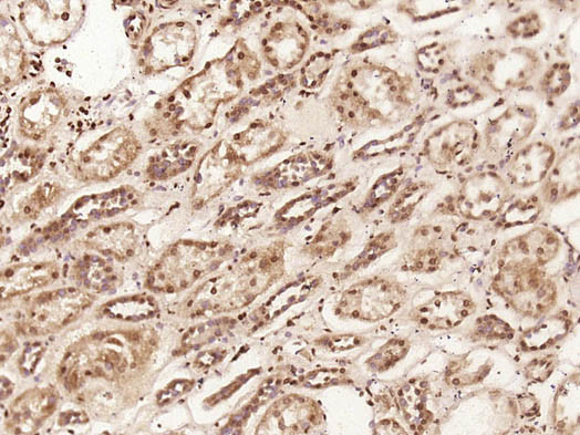 C1orf200 Antibody in Immunohistochemistry (Paraffin) (IHC (P))